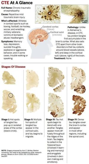 What CTE Does to The Brain
