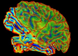3D Image of Brain in Color